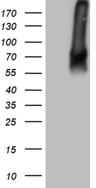 MET Antibody