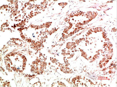 MET Antibody