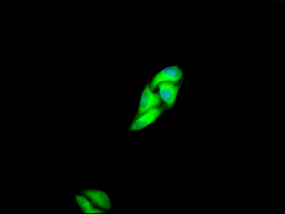 MET Recombinant Monoclonal Antibody