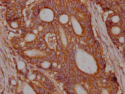 MET Recombinant Monoclonal Antibody