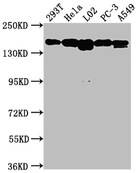 MET antibody