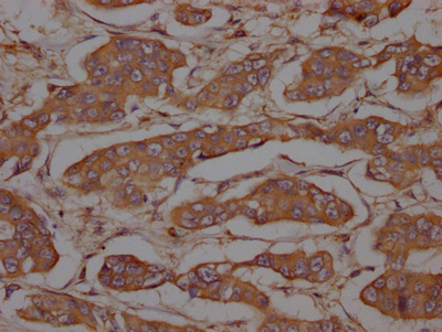 MET Recombinant Monoclonal Antibody