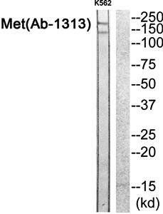 Met (Ab-1313) Antibody