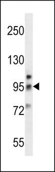 Metabotropic Glutamate Receptor 6 antibody