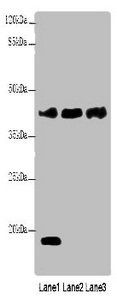 Metalloreductase STEAP1 antibody
