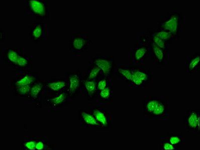 MT1E Antibody
