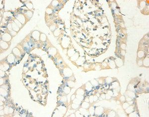 MT1X Antibody