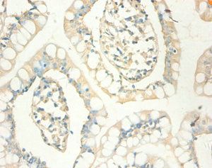 Metallothionein-1X antibody