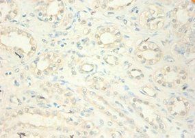 MT2A Antibody