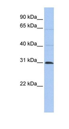 METTL11B antibody