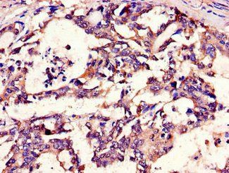 METTL14 Antibody
