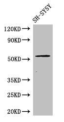 METTL14 antibody