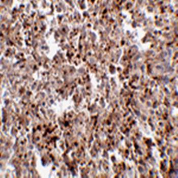 MettL7B Antibody