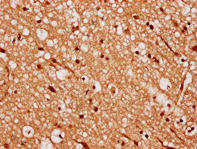 MEX3A Antibody