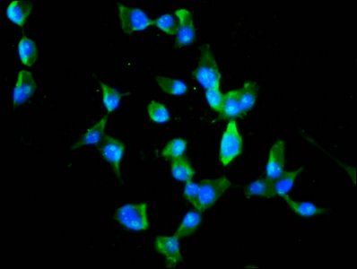 MEX3B Antibody