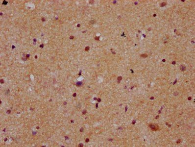 MEX3B Antibody