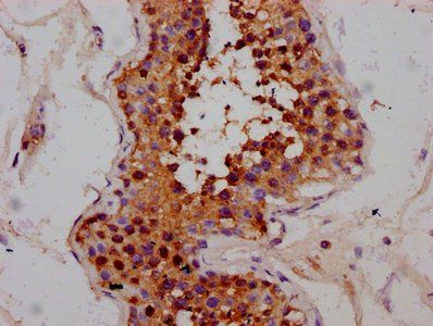 MEX3B Antibody