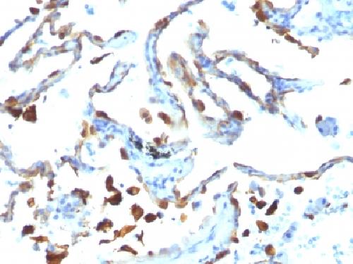 Milk Fat Globule (Breast Epithelial Marker) Antibody