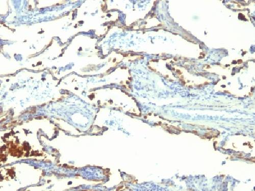 Milk Fat Globule (Breast Epithelial Marker) Antibody