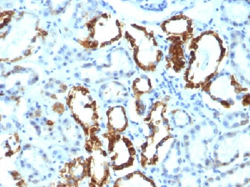 Milk Fat Globule (Breast Epithelial Marker) Antibody