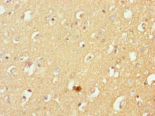 MFSD11 Antibody