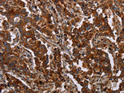 MFSD2A Antibody
