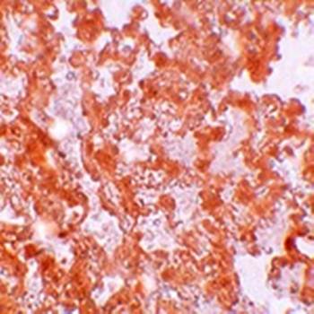 MFSD2A Rabbit Polyclonal Antibody