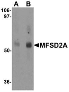 MFSD2A Rabbit Polyclonal Antibody