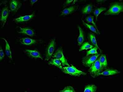MFSD5 Antibody