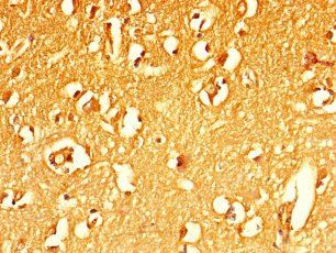 MFSD5 Antibody
