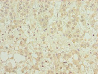 MFSD8 Antibody