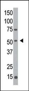 MGAT1 antibody