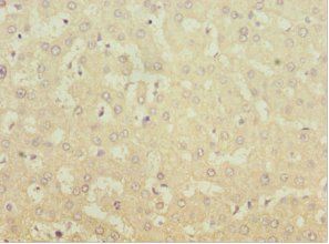 MGAT1 Antibody