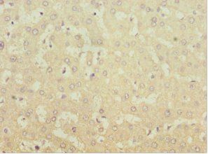 MGAT1 antibody