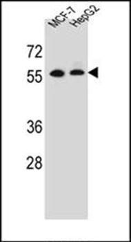MGAT2 antibody