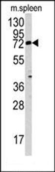 MGAT3 antibody