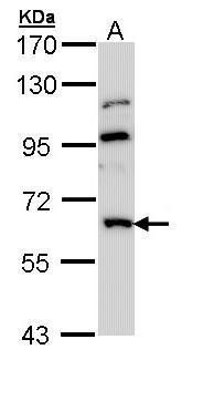 MGAT3 antibody