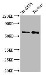 MGAT4B Antibody
