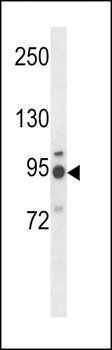 MGAT5 antibody