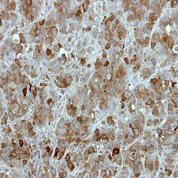 MGC16169 antibody