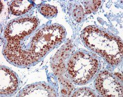 Goat anti-RACGAP1 / MgcRacGAP Antibody