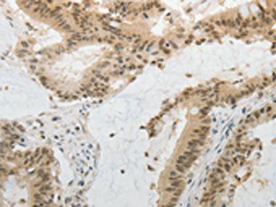 MGEA5 antibody