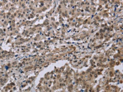 MGLL Antibody