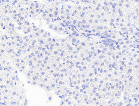 Goat anti-Monoglyceride Lipase Antibody