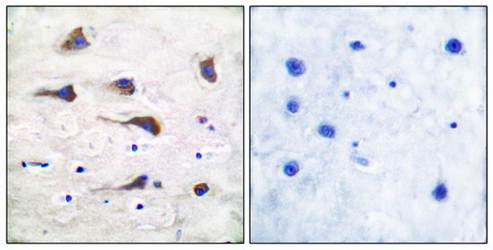 mGluR6 antibody