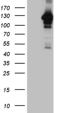 MGMT Antibody