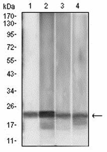 MGMT Antibody