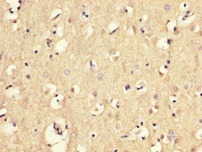 MGP Antibody