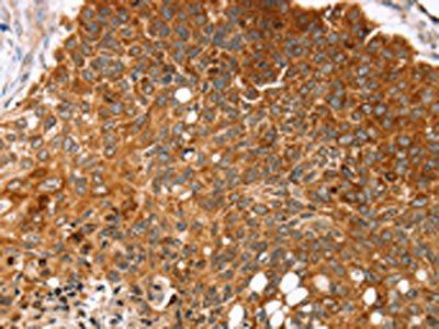 MGST1 Antibody
