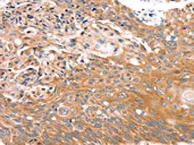 MGST1 Antibody